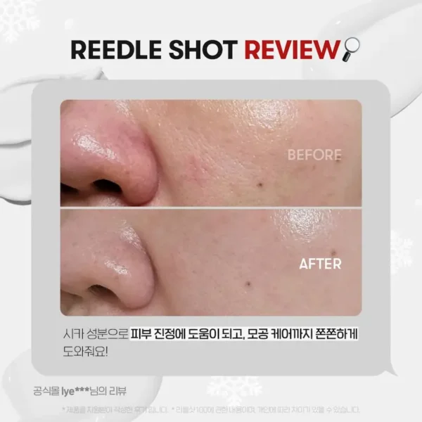 ریدل شات VT Reedle Shot 100 - Image 5