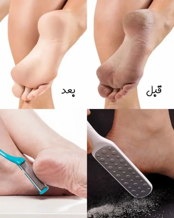 رنده و سوهان کف پا دو طرفه